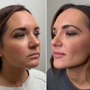 Eyebrow Tattoo result by VarAesthetics Medical Spa in Beaver, PA
