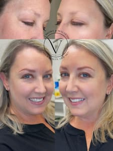 Eyebrow Tattoo result by VBROW in Tampa, FL