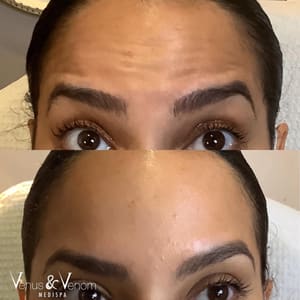 Eyebrow Tattoo result by Venus & Venom MEDIspa Monroe in Monroe, NY