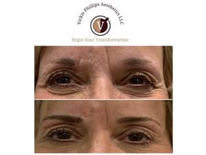 Eyebrow Tattoo result by Vickie Phillips Aesthetics LLC in Medina, OH