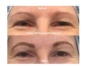 Eyebrow Tattoo result by Vickie Phillips Aesthetics LLC in Medina, OH