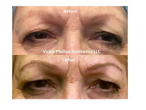 Eyebrow Tattoo result by Vickie Phillips Aesthetics LLC in Medina, OH