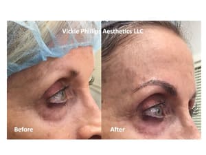 Eyebrow Tattoo result by Vickie Phillips Aesthetics LLC in Medina, OH