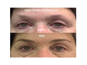 Eyebrow Tattoo result by Vickie Phillips Aesthetics LLC in Medina, OH