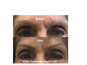 Eyebrow Tattoo result by Vickie Phillips Aesthetics LLC in Medina, OH