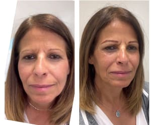 Eyebrow Tattoo result by Vida Bel Beauty Spa: Best Facials in Encino & Permanent Make-Up in Encino, CA