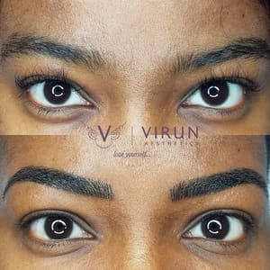 Eyebrow Tattoo result by Virun Aesthetics in Charlotte, NC