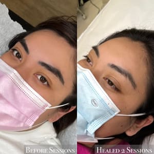 Eyebrow Tattoo result by éVoluer Beauty in San Jose, CA