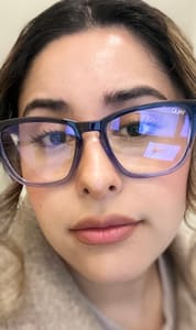 Eyebrow Tattoo result by Vybrows in San Jose, CA