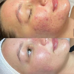 Eyebrow Tattoo result by Westhetics LLC in Southern Pines, NC