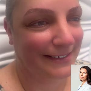 Eyebrow Tattoo result by White Iris Salon and Spa in Clearwater, FL