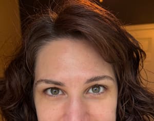 Eyebrow Tattoo result by Whoopsie Daisy Tattoo Removal in Martinsburg, WV