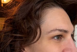 Eyebrow Tattoo result by Whoopsie Daisy Tattoo Removal in Martinsburg, WV