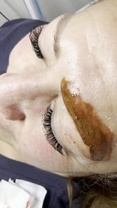 Eyebrow Tattoo result by XO Permanent Makeup /Skincare in Canoga Park, CA