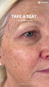 Eyebrow Tattoo result by YDerma Clinica in Apollo Beach, FL