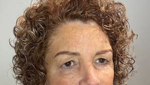 Eyebrow Tattoo result by Your Brow Nurse in South Fulton, GA