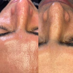 Eyebrow Tattoo result by Yuri Conde PMU & Esthetician NJ in Paramus, NJ