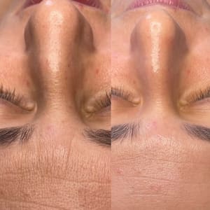 Eyebrow Tattoo result by Yuri Conde PMU & Esthetician NJ in Paramus, NJ