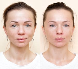 Eyebrow Tattoo result by ZagTiana Studio in Hallandale Beach, FL