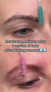 Eyebrow Tattoo result by Zoë Brow Slayer in North Tonawanda, NY