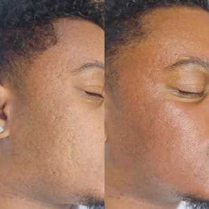 Eyeliner Tattoo result by A Joyful You Aesthetics in Wellington, FL