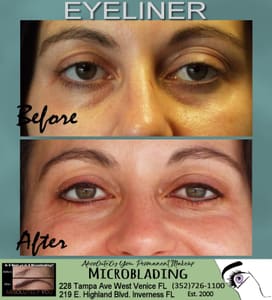Eyeliner Tattoo result by Absolutely You Permanent Makeup in Venice, FL