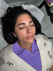 Eyeliner Tattoo result by Adrisofiastudio in Miami, FL