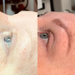Eyeliner Tattoo result by Advanced Skin Therapy of Clemmons, Inc in Clemmons, NC
