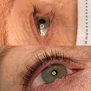 Eyeliner Tattoo result by Advanced Skin Therapy of Clemmons, Inc in Clemmons, NC