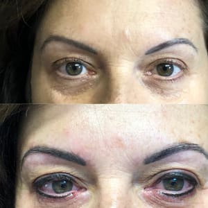 Eyeliner Tattoo result by Advanced Skin Therapy of Clemmons, Inc in Clemmons, NC