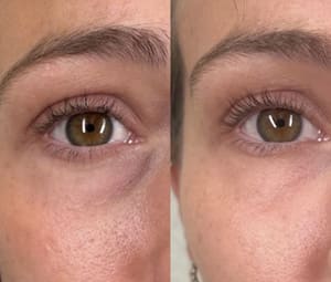 Eyeliner Tattoo result by Aesthetic Med Studio in Springfield, MO