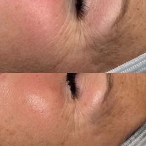 Eyeliner Tattoo result by Aesthetically Yours in Meridian, ID