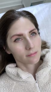 Eyeliner Tattoo result by Aesthetics Health in Mclean, VA