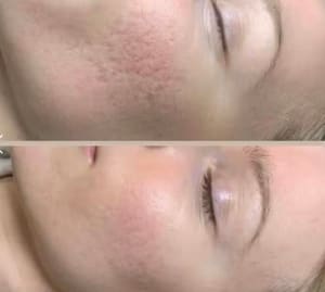 Eyeliner Tattoo result by Ageless Beauty Rx in Vancouver, WA
