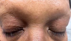 Eyeliner Tattoo result by Arlington NOVA LASER & 3D MICROBLADING in Arlington, VA