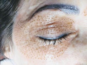 Eyeliner Tattoo result by Athena Beauty Bar in Allen, TX