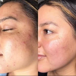 Eyeliner Tattoo result by Bare Beauty OC in Mission Viejo, CA