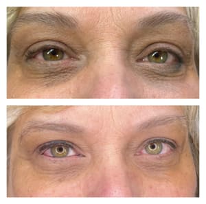 Eyeliner Tattoo result by Bdazzeled Brows LLC in Tipp City, OH