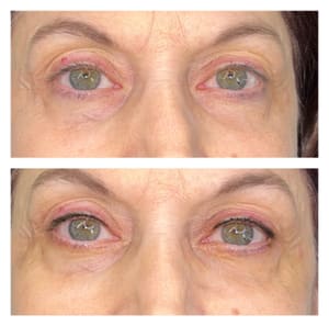 Eyeliner Tattoo result by Bdazzeled Brows LLC in Tipp City, OH