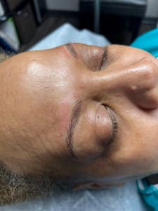 Eyeliner Tattoo result by Beauti4Skin Medspa n Laser in Spring, TX