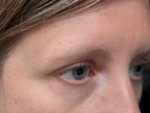 Eyeliner Tattoo result by Beauty By Chona in Folsom, CA