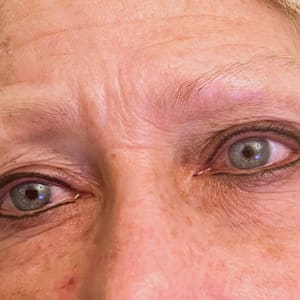 Eyeliner Tattoo result by Beauty Mark Permanent Makeup (Inside Bronzed N Beautiful) in Overland Park, KS