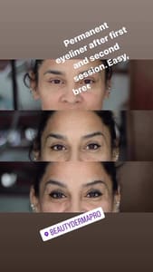 Eyeliner Tattoo result by BeautyDermaPro in Naples, FL