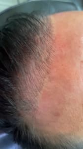 Eyeliner Tattoo result by Best Brows Microblading Beauty Clinique in San Antonio, TX