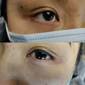 Eyeliner Tattoo result by Bling Bling Microblading & Permanent Makeup in Plano, TX