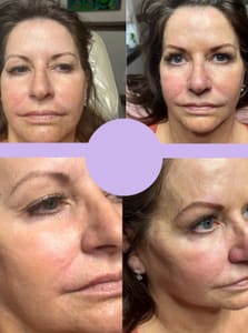 Eyeliner Tattoo result by Braded Beauty in King City, MO