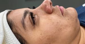 Eyeliner Tattoo result by Brenda's Lashes & Faciales in Harahan, LA