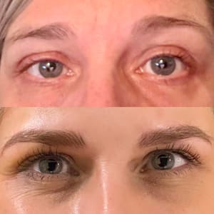 Eyeliner Tattoo result by Brow Art By Helen in Bothell, WA