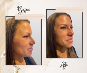 Eyeliner Tattoo result by Brow Paradiso in Hinsdale, IL