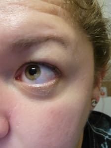 Eyeliner Tattoo result by Brow.RN_ in Minneapolis, MN